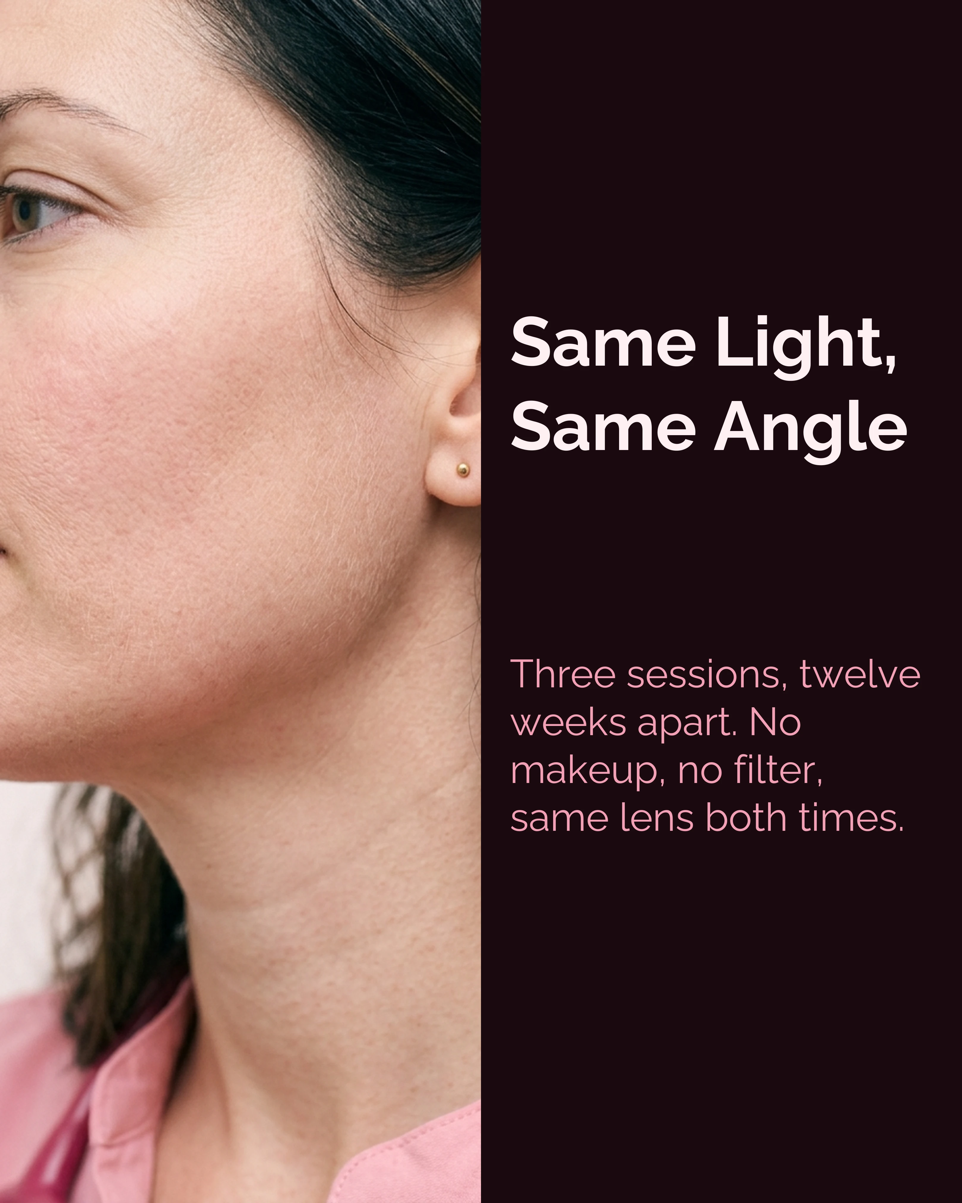 A close portrait under even clinical lighting
